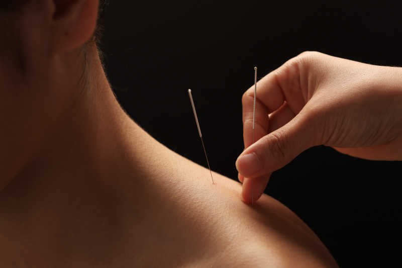 Acupuncture for chronic neck and back pain Flushing NY