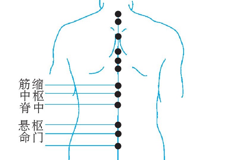 Lower back lumbar acupuncture treatment Flushing NY