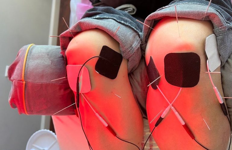 Physical rehabilitation therapy Flushing NY clinic